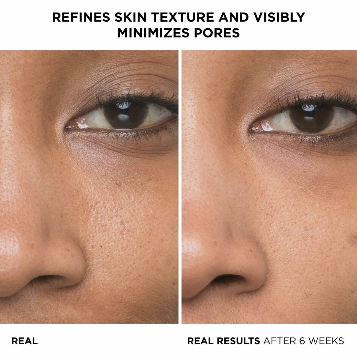 V3HF2281436D8A6B60CE932DF778EB98B34R6238555P2